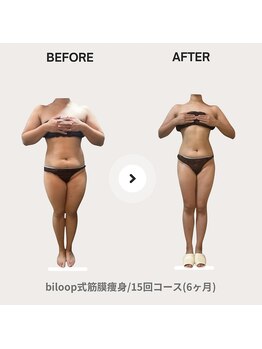 ビループ(biloop)/感動の結果をお見せします。