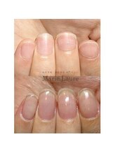 マリーロール 淀屋橋本店(Marie Laure)/深爪矯正/自爪育成/ネイルケア