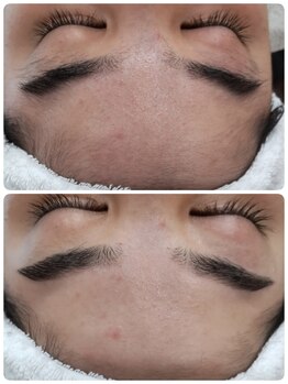 エステシェービングサロン フルール(Fleur)/眉毛のビフォーアフター