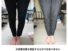 健康ケアセンター/O脚矯正