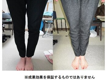 健康ケアセンター/O脚矯正
