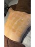 【ブライダル&背中産毛脱毛&ニキビケア】背中マツヤニWax　70分11000円⇒