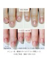最強のネイルケア３ケ月間コース