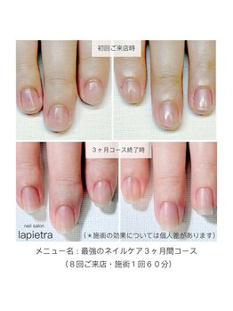 ネイルサロン ラピエトラ(la pietra)/最強のネイルケア3ケ月間コース