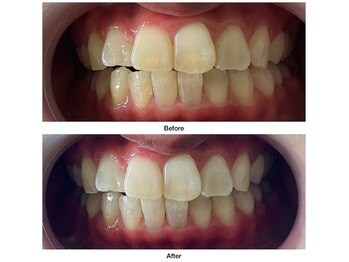 コアルナ センター北店(Coalna)/歯科提携・セルフホワイトニング