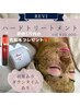 【深いお悩みに】剥けるハードピーリング 初回化粧水プレゼント♪