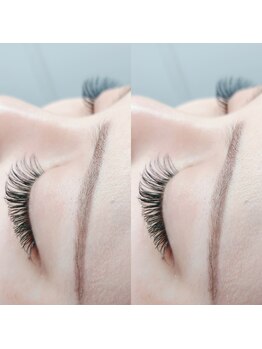 エネル バイ アルト(eneru by arto)/バインドロック