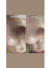 エピシアドットエヌ(epicia.N)/メンズもお肌のお手入れ