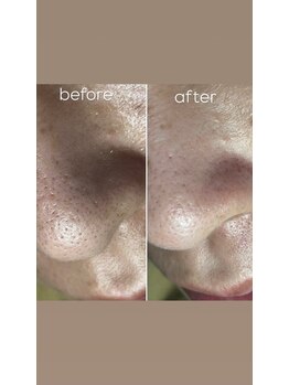 エピシアドットエヌ(epicia.N)/メンズもお肌のお手入れ