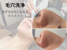 ベリル(BERYL)/ハーブ×毛穴洗浄/毛穴の黒ずみ