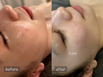 ムーマイニー(m maini)/普通肌→圧倒的美肌に