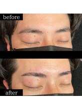 ユー 千葉駅前店(you)/ビフォーアフター写真