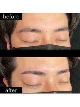 ユー 千葉駅前店(you)/ビフォーアフター写真