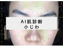 ホッコリ 段原店(HOKKORI)/AI肌診断～小じわ～