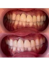 ルアナ 武蔵小杉店(Luana)/医療提携セルフホワイトニング