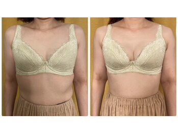 マリール(Marire)/40代　施術1回