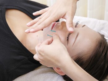 ネイビー鍼灸指圧治療院(NAVY鍼灸指圧治療院)/肌が変わる美容鍼!