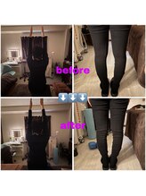 エリシオン(ELYSION)/整体骨盤ビフォーアフター