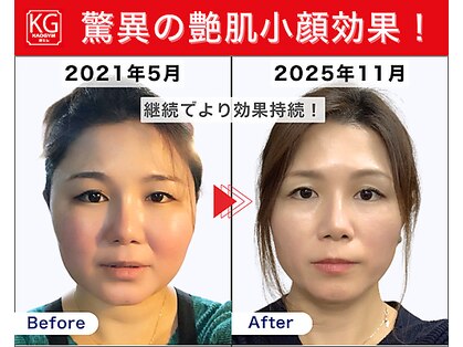 顔ジム 麻布店の写真