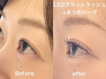 ライラック 二子玉川(Lilac)/マツエクLED フラットラッシュ