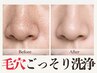 【毛穴徹底ケア】ハイドロクレンズ水素毛穴洗浄☆鼻の毛穴が黒ずむ前に