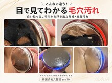 マリア(MALIA)の雰囲気(#韓国式毛穴#角栓チンアナゴ#esv10南森町#大阪esv10導入サロン)