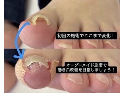 巻き爪じゅん 津田沼駅前店の写真