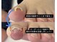 巻き爪じゅん 津田沼駅前店の写真