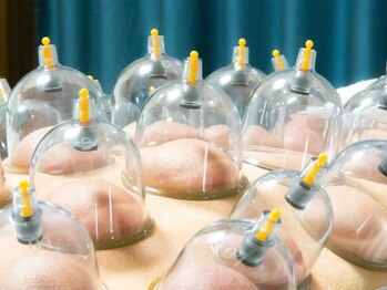 健美癒 ラ サンテ/カッピング【2】