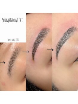 ジル(JILL)/札幌初上陸Plump Brow Lift