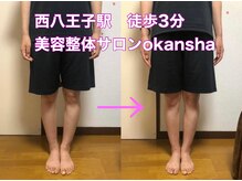 美容整体サロン オオカンシャ(okansha)/O脚Before→after