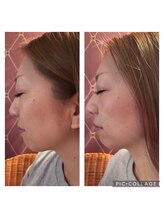 エステサロンケードット(Esthetic Salon K.)/小顔調整コース