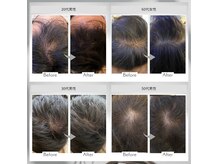 ワイビューティ(Y.Beauty)の雰囲気(GROTTY(グロッティ)育毛促進ケア♪20代~70代のお客様が満足!)