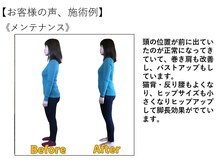 江坂回復アップラボ/お客様の声、施術例