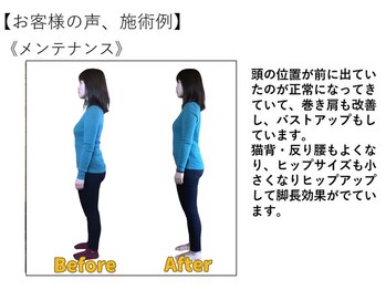 江坂回復アップラボ/お客様の声、施術例