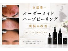 ユアーズ ビューティー(YOURS beauty)の雰囲気（ニキビ・毛穴・くすみへ根本からアプローチする施術）
