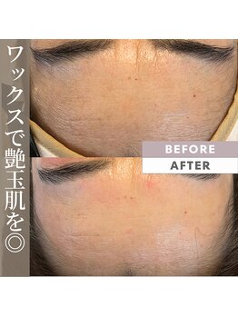 フリージア(Freesia)/フェイスワックスで艶玉美肌に◎