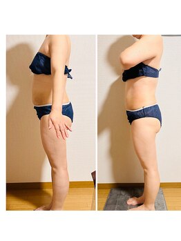 ソフィアアイズ 倉敷店(SOPHIAEYES)/ハイパーナイフ(ダイエット)