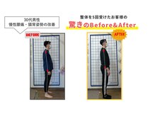 にこにこ整体 整骨院/【腰痛・猫背矯正】整体をBE⇒AF