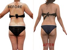 ルッカ(RUKKA)/ゆる痩せ♪