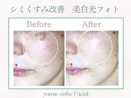 トータルビューティー ゆみえエステ(Total Beauty)の写真