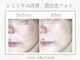 トータルビューティー ゆみえエステ(Total Beauty)の写真