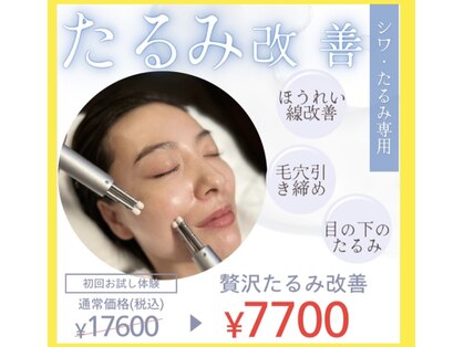 エトワール(Etoile)の写真