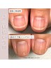 【爪強化用トップコートで自爪育成集中コース】一括払い￥71,000-¥68,000-