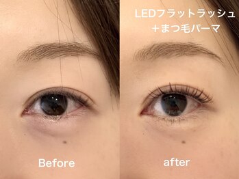 ライラック 二子玉川(Lilac)/マツエクLED フラットラッシュ