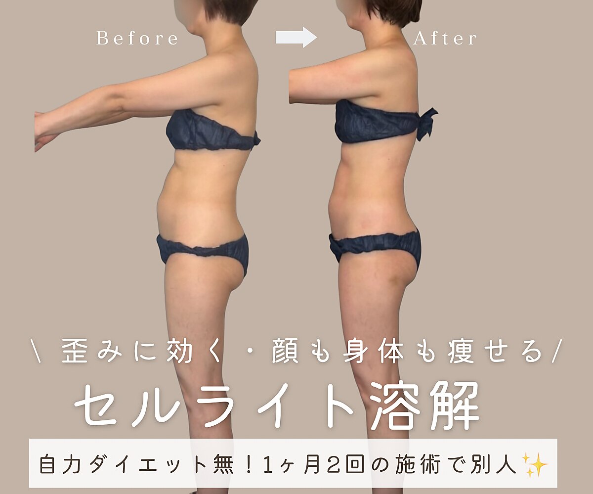 エイトヒーリング(8Healing)｜ホットペッパービューティー