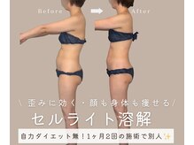 エイトヒーリング(8Healing)の雰囲気（当店の溶解は骨格改善できるのでもうダイエットで失敗しない！）