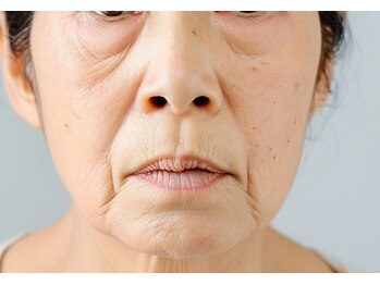 アンド(and...)の写真/ほうれい線・フェイスラインのたるみに。話題のノーボトッ○スフェイシャルでハリと弾力を