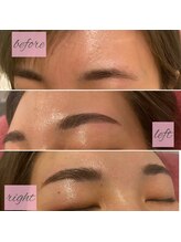 アンドエラ(&ERA)/ナチュラルブロウリフト