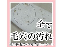 エクラーレ(Eclale)/【毛穴ケア】症例